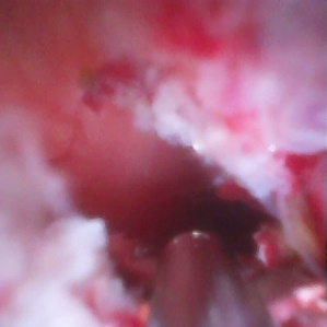 胆什么导管一目了然！胆胰成像导管操作技术——让胆胰管疾病无处遁形！_https://www.jmylbn.com_新闻资讯_第5张