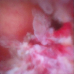 胆什么导管一目了然！胆胰成像导管操作技术——让胆胰管疾病无处遁形！_https://www.jmylbn.com_新闻资讯_第4张