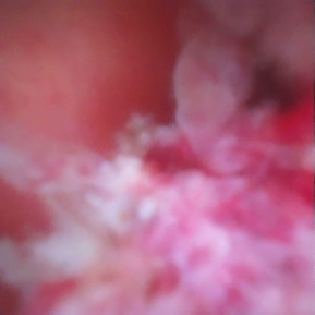 胆什么导管一目了然！胆胰成像导管操作技术——让胆胰管疾病无处遁形！_https://www.jmylbn.com_新闻资讯_第3张