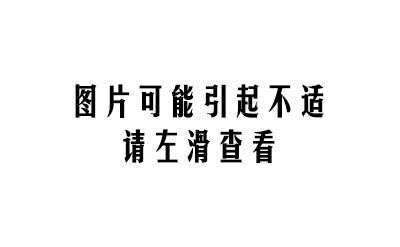 男孩肺被炸成爆米花，罪魁禍首也許你家也有！ 親子 第11張