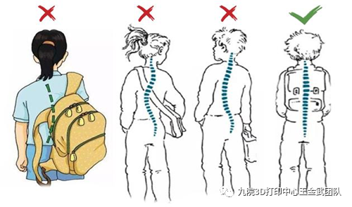 家长"鸡娃""内卷",谁来关照孩子的脊柱健康避免脊柱侧弯 - 好大夫在线