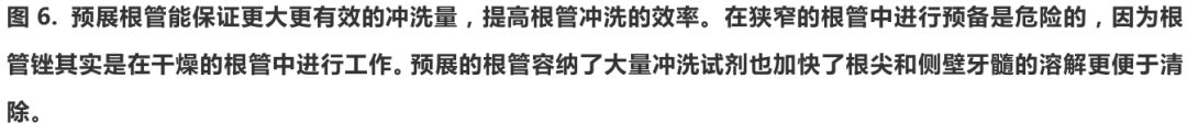 根管冠方预展，一个步骤让根管变得简单！
