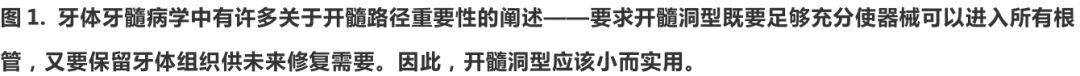 根管冠方预展，一个步骤让根管变得简单！