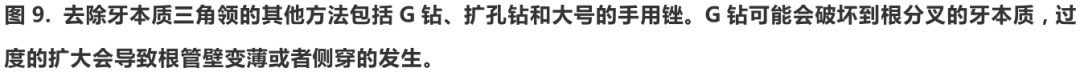 根管冠方预展，一个步骤让根管变得简单！