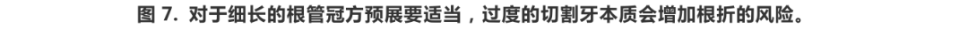根管冠方预展，一个步骤让根管变得简单！