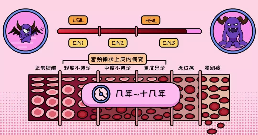 宮頸病變就是癌?這種情況要警惕_醫學界-助力醫生臨床決策和職業成長