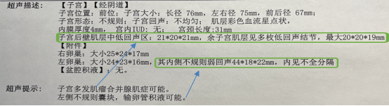 b超md是什么意思妇科B超能查啥？怎么看结果？异常情况会这样描述_https://www.jmylbn.com_新闻资讯_第3张