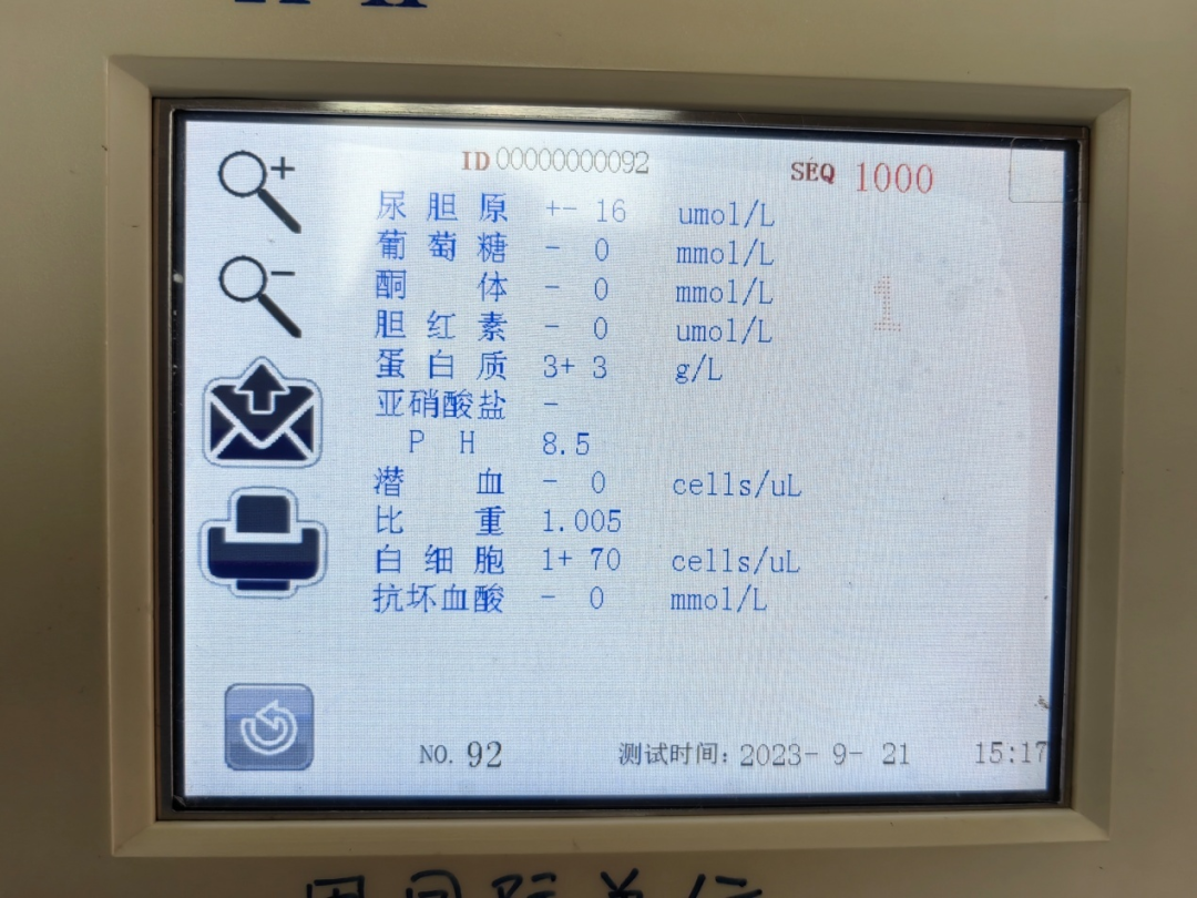 为什么要做尿液分析仪一例尿液干化学分析仪测定尿蛋白质与全自动生化分析仪测定尿微量白蛋白结果差异引发的思考_https://www.jmylbn.com_新闻资讯_第1张