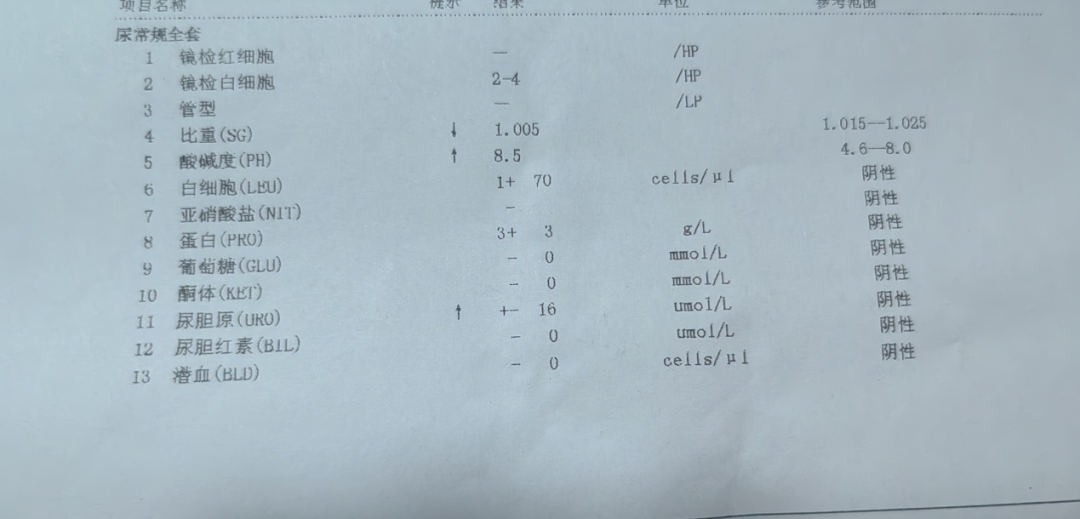 为什么要做尿液分析仪一例尿液干化学分析仪测定尿蛋白质与全自动生化分析仪测定尿微量白蛋白结果差异引发的思考_https://www.jmylbn.com_新闻资讯_第2张