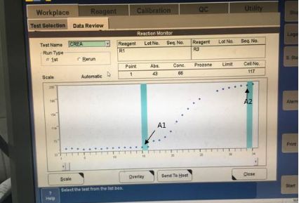 生化仪怎么定标检验结果出现了负值？原因是......_https://www.jmylbn.com_新闻资讯_第2张