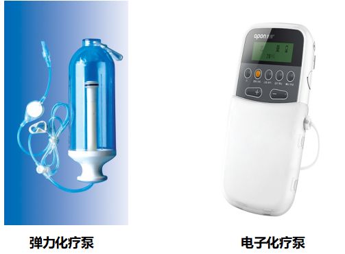 电子输注泵起什么作用精准把控，“泵”向健康！便携式化疗泵你了解多少？_https://www.jmylbn.com_新闻资讯_第6张