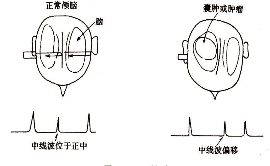 彩超logiq怎么读B超、彩超“傻傻分不清楚”？其实区别就在这！_https://www.jmylbn.com_新闻资讯_第5张