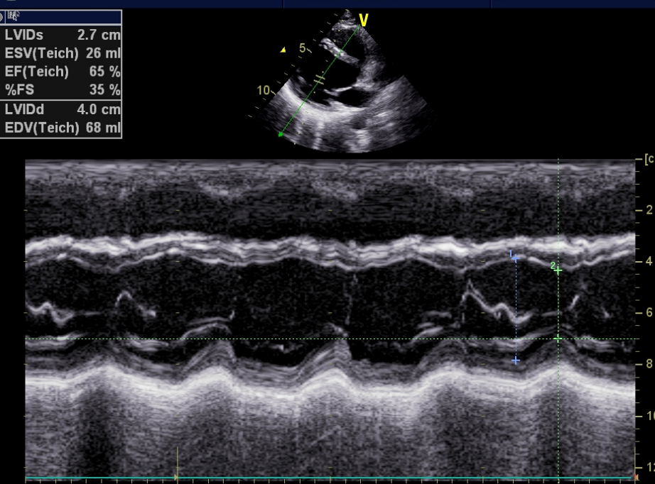 彩超logiq怎么读B超、彩超“傻傻分不清楚”？其实区别就在这！_https://www.jmylbn.com_新闻资讯_第7张