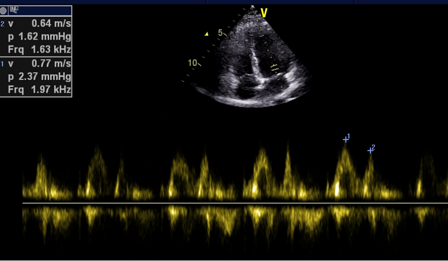 彩超logiq怎么读B超、彩超“傻傻分不清楚”？其实区别就在这！_https://www.jmylbn.com_新闻资讯_第8张