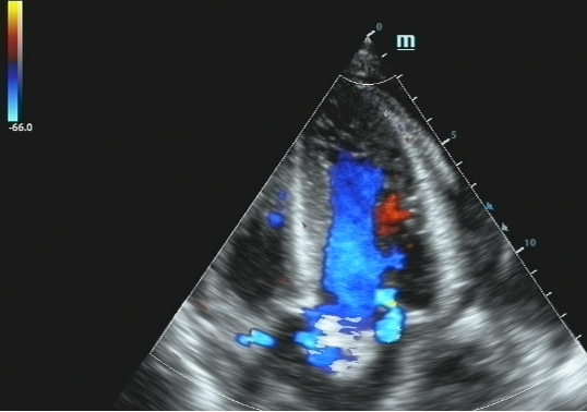 彩超logiq怎么读B超、彩超“傻傻分不清楚”？其实区别就在这！_https://www.jmylbn.com_新闻资讯_第9张