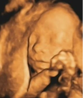 彩超logiq怎么读B超、彩超“傻傻分不清楚”？其实区别就在这！_https://www.jmylbn.com_新闻资讯_第10张