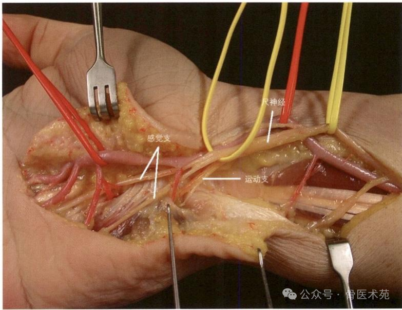 手术入路：腕水平尺神经手术入路（详细手术图解）