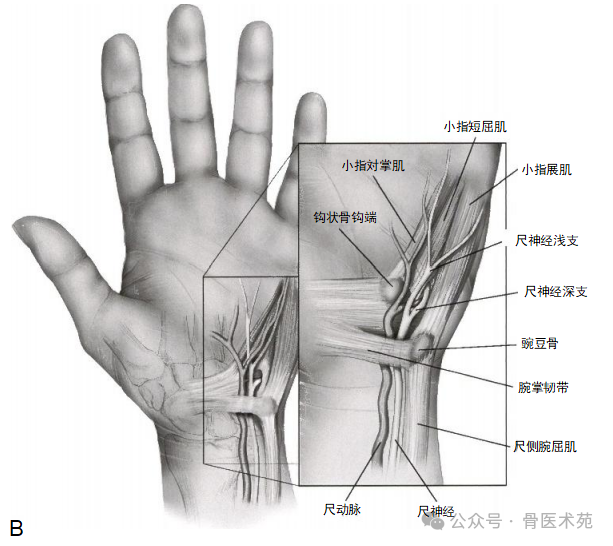 手术入路：腕水平尺神经手术入路（详细手术图解）