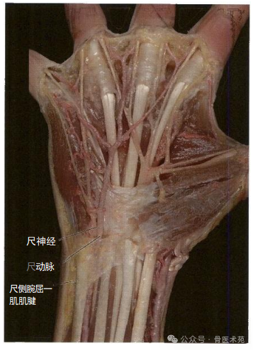 手术入路：腕水平尺神经手术入路（详细手术图解）