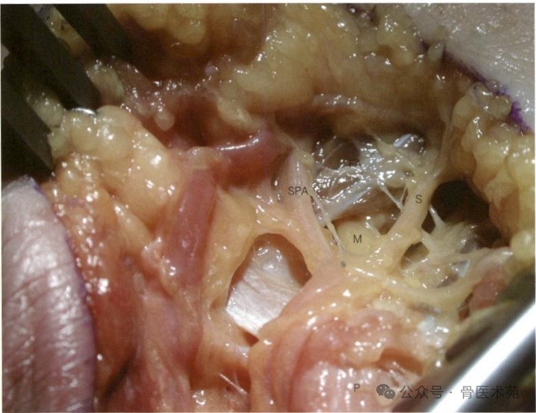 手术入路：腕水平尺神经手术入路（详细手术图解）