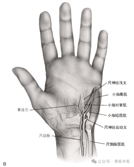 手术入路：腕水平尺神经手术入路（详细手术图解）