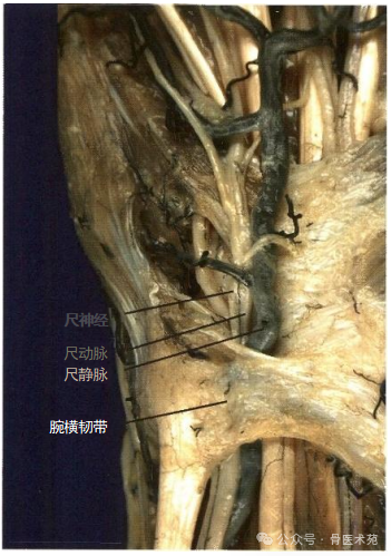 手术入路：腕水平尺神经手术入路（详细手术图解）