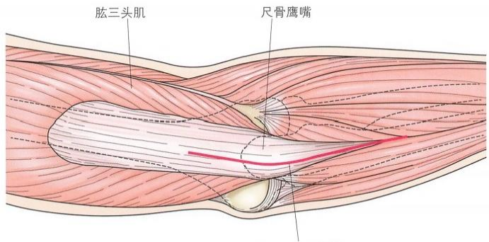 复杂性肘关节骨折的手术治疗技术