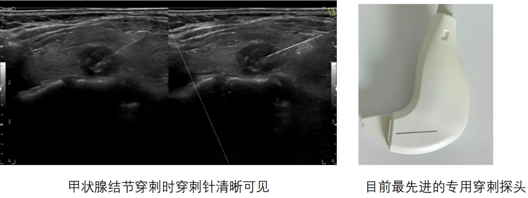 logiq e怎么读【精准医疗 影像先行】五代超高端全身应用彩色多普勒超声诊断仪GE LOGIQ E11在我院投入使用_https://www.jmylbn.com_新闻资讯_第6张