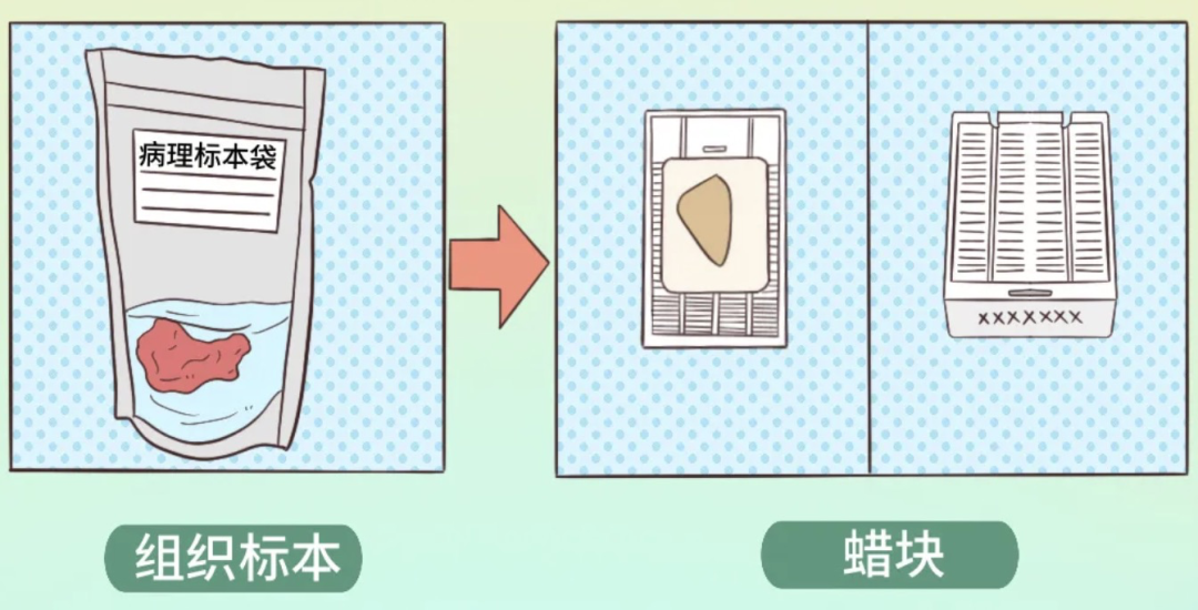 什么是病理蜡块白片、HE切片、免疫组化切片都是啥？一文揭开“病理借片”的神秘面纱_https://www.jmylbn.com_新闻资讯_第4张