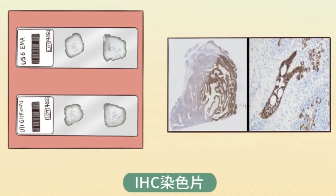 什么是病理蜡块白片、HE切片、免疫组化切片都是啥？一文揭开“病理借片”的神秘面纱_https://www.jmylbn.com_新闻资讯_第7张