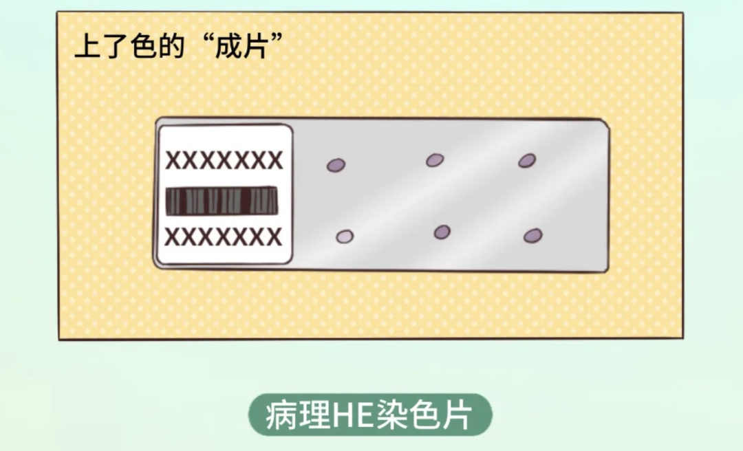 什么是病理蜡块白片、HE切片、免疫组化切片都是啥？一文揭开“病理借片”的神秘面纱_https://www.jmylbn.com_新闻资讯_第6张
