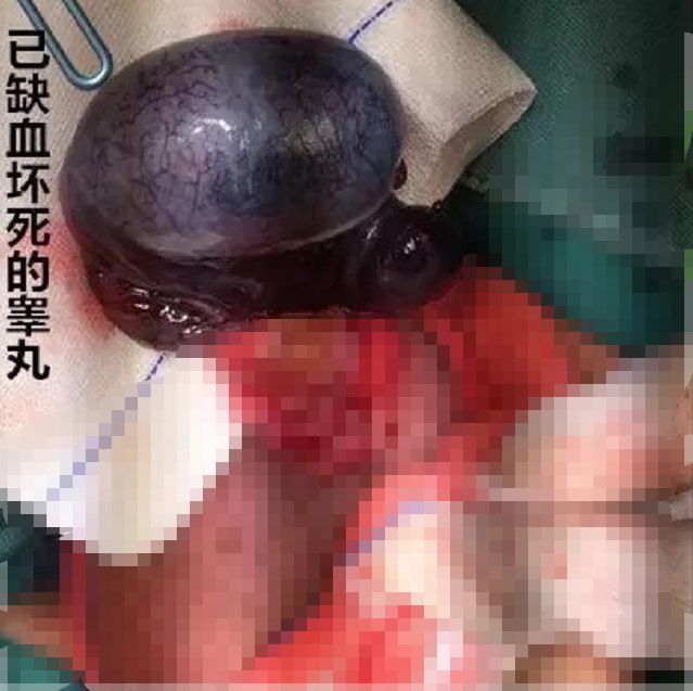 17岁男孩丁丁和3岁小孩一样大！父母一个疏忽，坑了他一辈子（组图） - 9