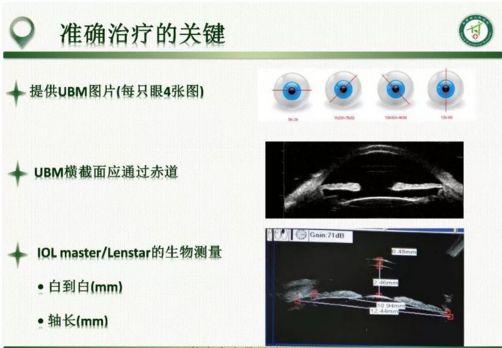 【不開刀,無創治療青光眼】ucp超聲睫狀體成形術正式落戶湖南博雅眼科