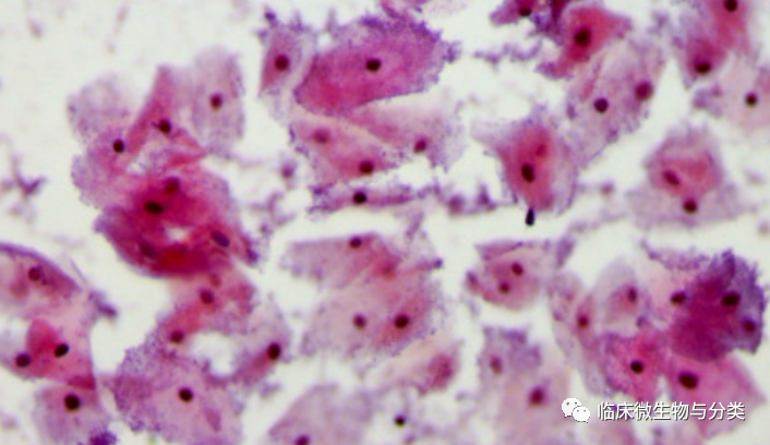BV唾液酸酶是什么加德纳属修订：3个新种及13个基因种_https://www.jmylbn.com_新闻资讯_第2张