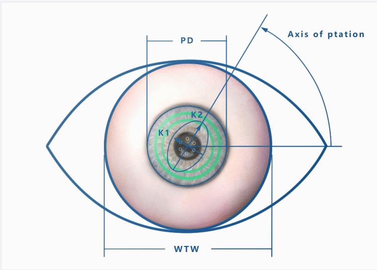 眼科生物测量仪怎么看视力无增长案例  ▏教你如何掌握生物测量的8组数据_https://www.jmylbn.com_新闻资讯_第7张