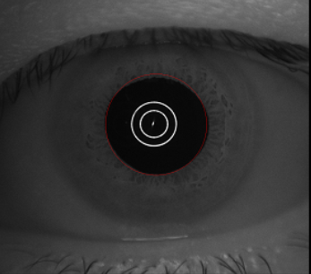 眼科生物测量仪怎么看视力无增长案例  ▏教你如何掌握生物测量的8组数据_https://www.jmylbn.com_新闻资讯_第10张