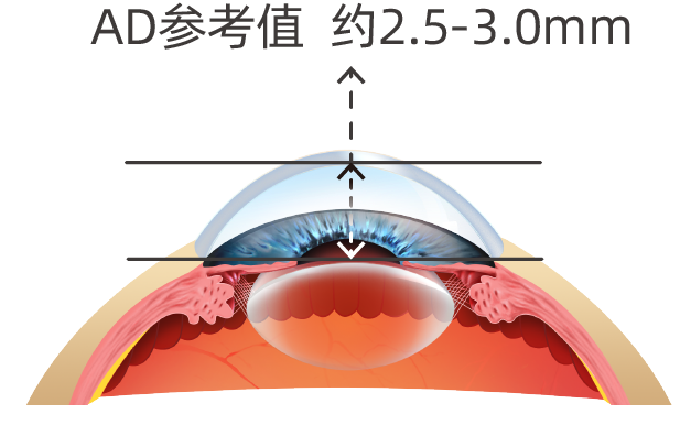 眼科生物测量仪怎么看视力无增长案例  ▏教你如何掌握生物测量的8组数据_https://www.jmylbn.com_新闻资讯_第9张