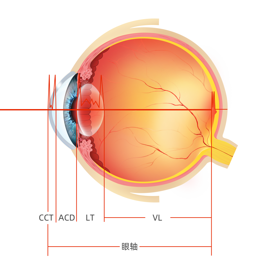 眼科生物测量仪怎么看视力无增长案例  ▏教你如何掌握生物测量的8组数据_https://www.jmylbn.com_新闻资讯_第5张