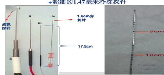 氦氩刀是什么【每日一方】氩氦刀-让肿瘤感受冰火两重天！_https://www.jmylbn.com_新闻资讯_第1张