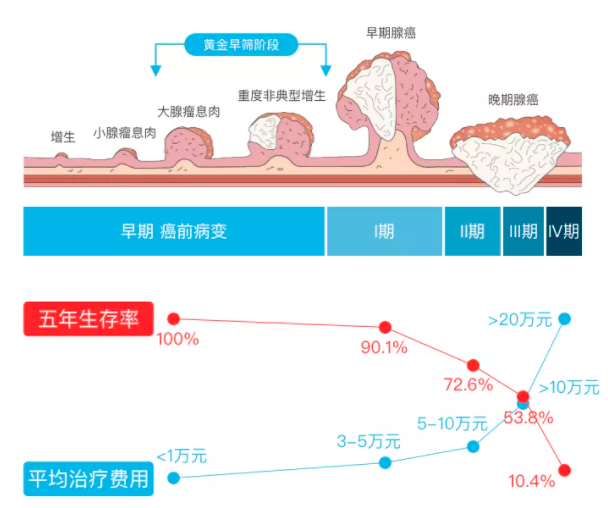 新方法 在家就能搞定的肠癌筛查来了 全网搜