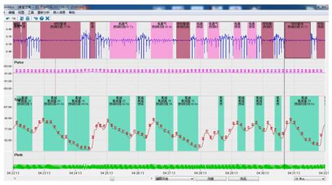 睡眠呼吸初筛仪怎么用可以带回家的便携式睡眠初筛仪  秒睡打鼾的你不来试试么？_https://www.jmylbn.com_新闻资讯_第13张