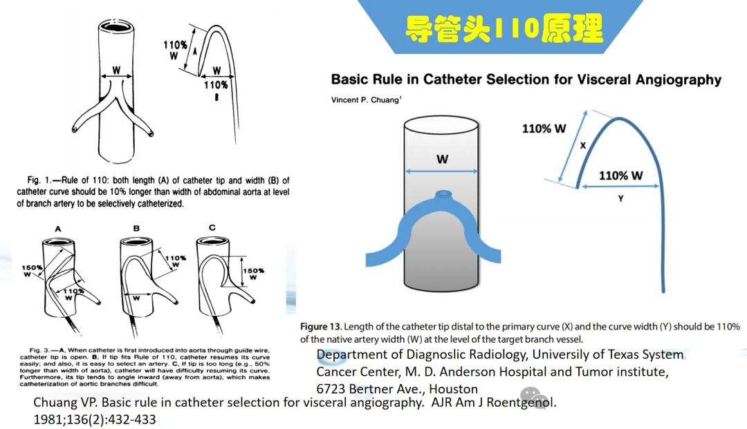 不会导管导丝基本操作?