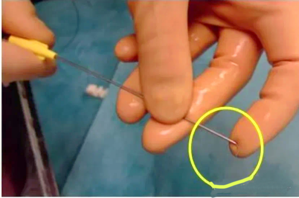 不会导管导丝基本操作?