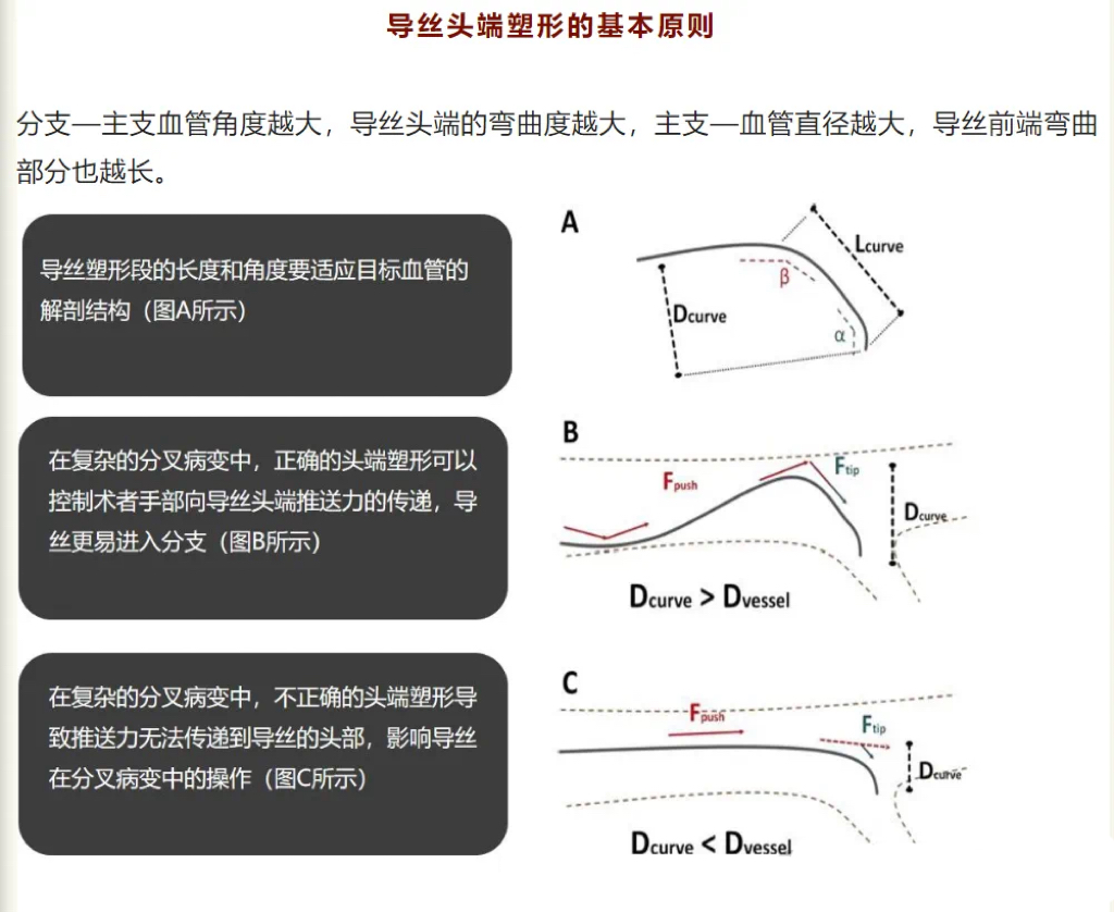 不会导管导丝基本操作?