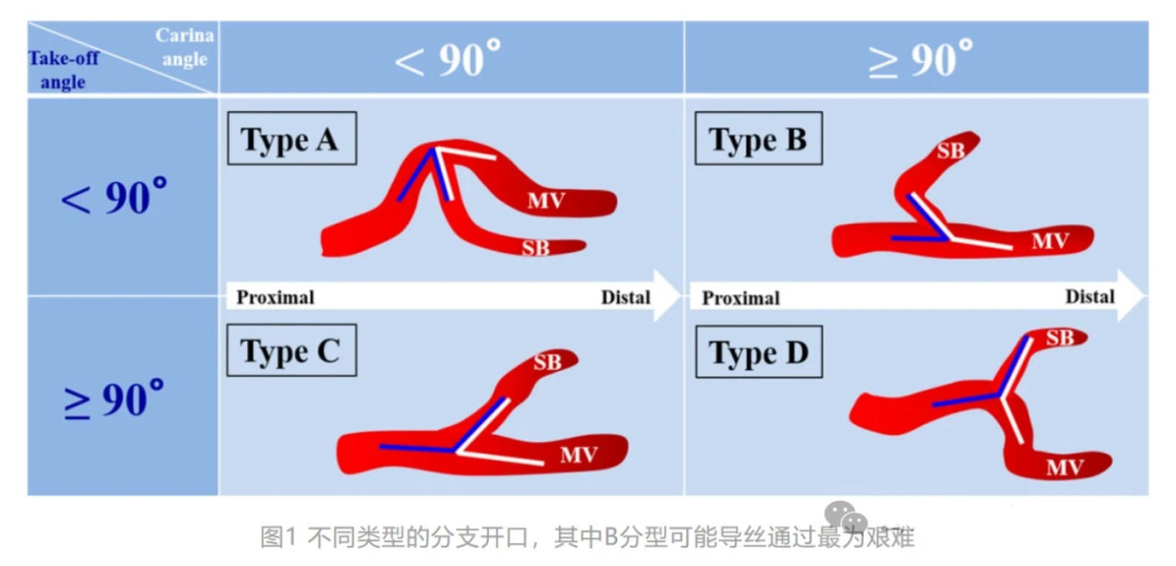 不会导管导丝基本操作?
