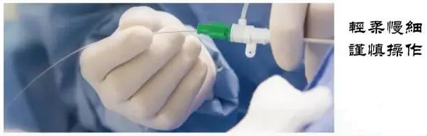 详细图解经桡动脉导管打折的处理方法