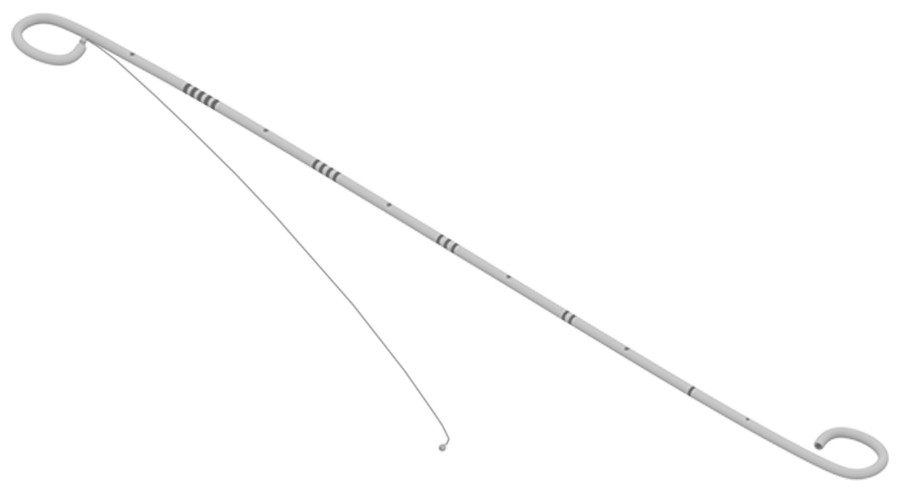 猪输尿管怎么吃输尿管碎石术后怎么要留“管子”？_https://www.jmylbn.com_新闻资讯_第3张