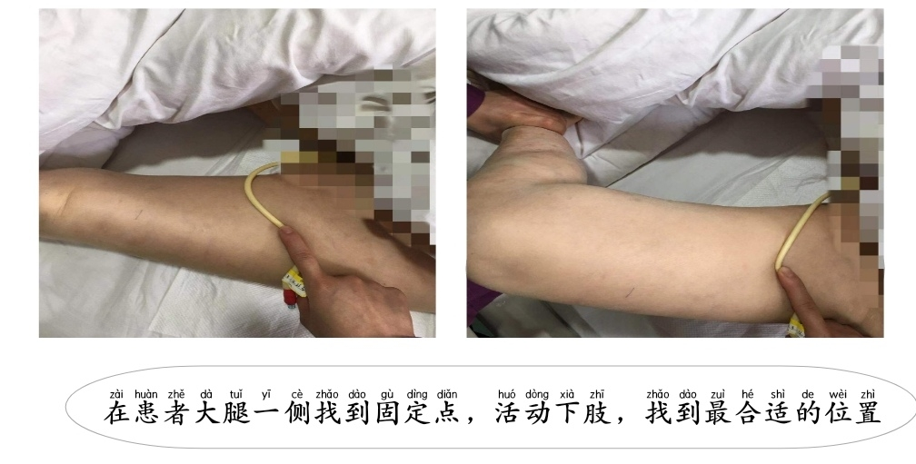 体表导管固定怎么使用【专科护理】牢固定  与“脱管”说再见--导管固定贴这样使用更轻松_https://www.jmylbn.com_新闻资讯_第5张