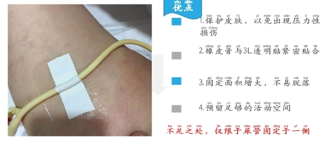 体表导管固定怎么使用【专科护理】牢固定  与“脱管”说再见--导管固定贴这样使用更轻松_https://www.jmylbn.com_新闻资讯_第7张