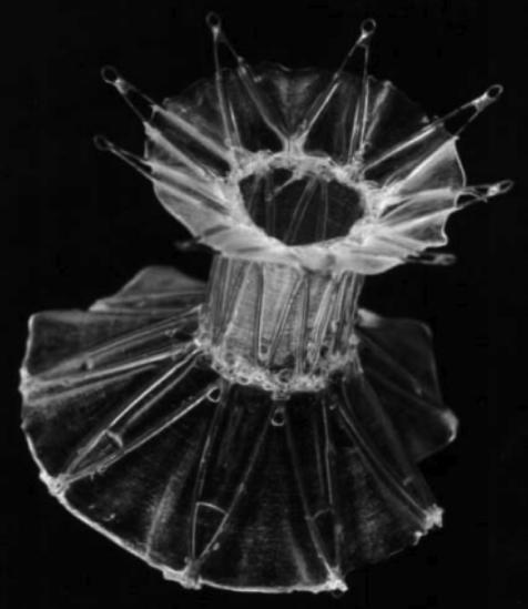 胃肠吻合时需要哪些器械【干货收藏】内镜下胃肠吻合术之磁体吻合_https://www.jmylbn.com_新闻资讯_第6张